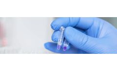 PCR Diagnostic