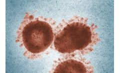 Nanoparticle Concentration Analysis Device for Viruses Industry