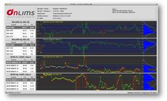 Online Quality Charting System