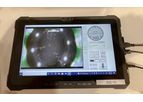 Smart Shaft Inspection System