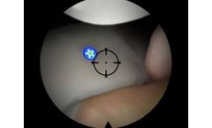 Hip Diagnostics Module