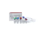 Model FungiXpert - Fungus (1-3)-β-D-Glucan Detection Kit (Chromogenic Method)