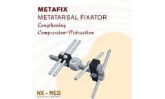Nafx NX-MED Metafix - Monoplanar Compression-Distraction External Bone Fixators