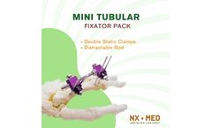 Nafx NX-MED - Mini Tubular Fixator