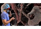 Surgical Planning Services