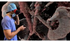 Surgical Planning Services
