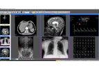 Santesoft - Sante DICOM Viewer Pro - Medical Image Management Software