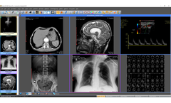Santesoft - Sante DICOM Viewer Pro - Medical Image Management Software