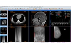 Sante - Sante DICOM Viewer for Mac