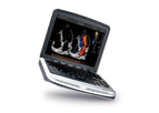 Rothband - Model SonoBook8 - Portable Colour Doppler System