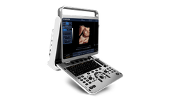Xray4Vets - Model EBit30 - Ultrasound Display Unit