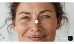 TruDiagnostic - Model OMICmAge  - Algorithm for Biological Age Measurement