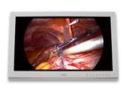 Double Black Imaging - Model C26SF-1 - 26-inch Surgical Operating Room Display