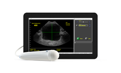 SeeMore - Model ViewBladder10 - Bladder Scanner Tablet