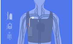 Seraccess - Model SENSE - Unrivalled Artificial Pancreas for Unmanageable Diabetes