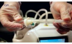 TopiVac T-NPWT Wound Care - Vacuum + Oxygen & Ozone Gas + Irrigation Therapy Application - Video