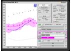 Audioscan - Version Axiom - Standard Hearing Instrument Verification Software