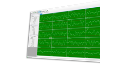 Data Collection, Quality Analysis & SPC Software
