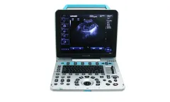 Dawei - Model P5-VET - Portable Veterinary Ultrasound System for Pets