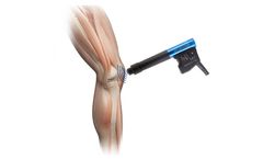 Inceler Medikal - Model Modus  - Radial ESWT Device for Shockwave Therapy