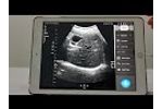 Double Probes Wireless Handheld Ultrasound Scanner-D5CE - Video