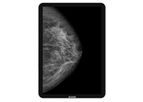 Jusha - Model CP620 - 6MP Portable Medical Grade Tablet Monitor