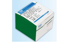 TIB - Model p16 - Protein/Ki-67 Dual Staining Kit for Cell Cycle and Lesion Detection