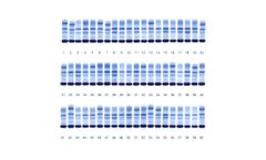Helena Biosciences - SAS Serum Proteins