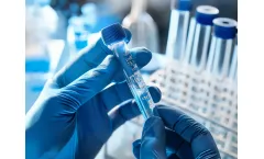 Shotgun Metagenomics Services