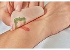 Grapheal WoundLAB - Electronic Wound Patch