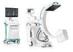 Ziehm Vision - RFD 3D Mobile C-arm for Surgical X-Ray Imaging