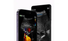 Vscan Air App