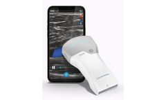 Vscan - Model Air™ CL - High-performance Ultrasound Machine