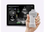 Vscan - Model Air™ SL with Caption AI - Rapid Echocardiographic Assessments Machine