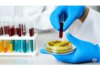Green Solution Laboratory - Microbiological Testing Services in Maharashtra | Food, Water & Environment Testing by Green Solution Lab