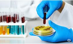 Green Solution Laboratory - Microbiological Testing Services in Maharashtra | Food, Water & Environment Testing by Green Solution Lab