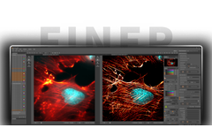 MicroscopeX FINER - Versatile Image Enhancement Software