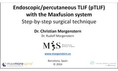 Endoscopic percutaneous TLIF (pTLIF) with MaxFusion System - Video