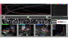 BlazeMetrics - Version ID-CLD - Image Analysis Derived Chord Length Distribution Software