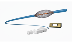 Galvanize RheOx - Investigational Device for Chronic Bronchitis Treatment