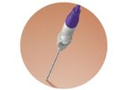 Galvanize Aliya - PEF System for Soft Tissue Ablation