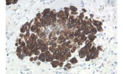 IHC Routine Service