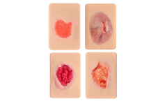 Ultrassist - Pocket-Sized Granulation Tissue Wound Simulation Model Set