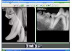 IWV - Version ViewAll™ 5.0 - Veterinary Dental Imaging Software