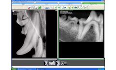 IWV - Version ViewAll™ 5.0 - Veterinary Dental Imaging Software