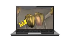 Tizian - Creativ RT CAD Software for Dental Modeling
