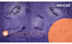 exocad - Version DentalCAD 3.2 Elefsina - Software Solution for Digital Dentistry