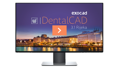 exocad - Version DentalCAD 3.1 Rijeka - Renowned Software Solution