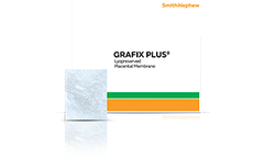 GRAFIX PLUS - Placental Membrane for Chronic Wound Management