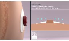 Genii™ Ostomy Seal - How to Guide - Video